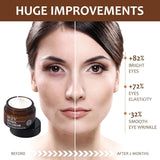 IREV- Retinol Eye Cream 30 ml